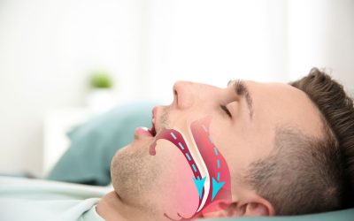Apnea del sueño: en qué consiste y por qué es importante detectarla a tiempo